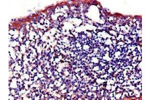 Immunohistochemistry of paraffin-embedded human tonsil tissue using ABIN7156864 at dilution of 1:100 (IL23R Antikörper  (AA 15-125))