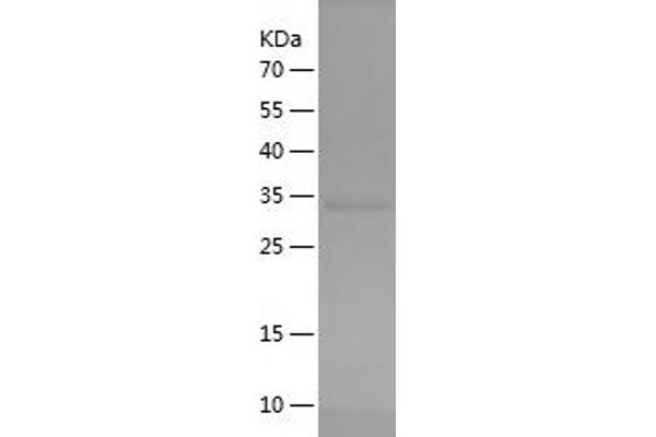 TTF1 Protein (AA 1-224) (His tag)