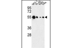 Western blot analysis of AIM2 Antibody (N-term) (ABIN653833 and ABIN2843099) in MCF-7, HL-60, K562, Hela cell line lysates (35 μg/lane). (AIM2 Antikörper  (N-Term))