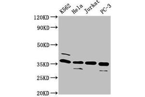 Western Blot Positive WB detected in: K562 whole cell lysate, Hela whole cell lysate, Jurkat whole cell lysate, PC-3 whole cell lysate All lanes: ATG3 antibody at 4 μg/mL Secondary Goat polyclonal to rabbit IgG at 1/50000 dilution Predicted band size: 36 kDa Observed band size: 36 kDa (ATG3 Antikörper  (AA 1-314))