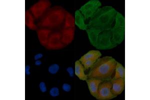 ABIN6258760 and ABIN6274383 staining Hela cells(30 min of UV treatment) by IF/ICC.