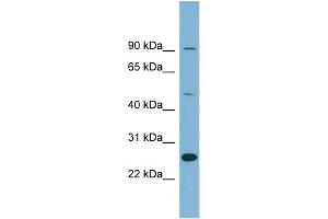 WB Suggested Anti-LRRC49 Antibody Titration: 0. (LRRC49 Antikörper  (N-Term))