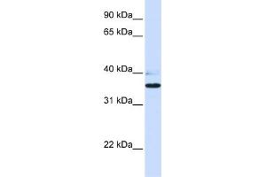Western Blotting (WB) image for anti-UDP-Gal:betaGlcNAc beta 1,3-Galactosyltransferase, Polypeptide 1 (B3GALT1) (N-Term) antibody (ABIN2783816)