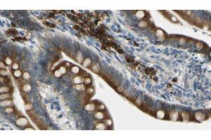 ABIN6276238 at 1/100 staining Mouse intestine tissue by IHC-P. (GIPR Antikörper  (Internal Region))