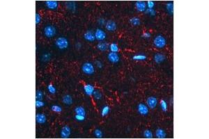 Immunohistochemistry (IHC) image for anti-Beta-secretase 1 (BACE1) (N-Term) antibody (ABIN2782766)