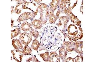 Immunohistochemical analysis of paraffin-embedded mouse kidney section using SPHK1 antibody; Ab was diluted at 1:100 dilution. (SPHK1 Antikörper  (AA 59-89))