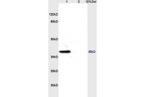 L1 rat brain lysates L2 rat kidney lysates probed with Anti- CD184/CXCR4 Polyclonal Antibody, Unconjugated (ABIN730888) at 1:200 overnight at 4 °C. (CXCR4 Antikörper  (AA 201-294))