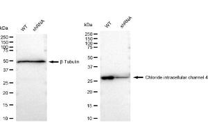 Western blotting analysis using Chloride intracellular channel 4 antibody (ABIN7798051). (Rekombinanter CLIC4 Antikörper)