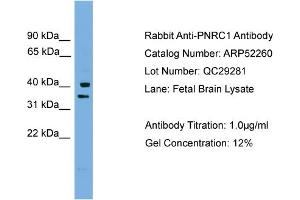 WB Suggested Anti-PNRC1  Antibody Titration: 0.
