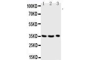 Anti-Granzyme A antibody, Western blotting Lane 1: JURKAT Cell Lysate Lane 2: CEM Cell Lysate Lane 3: RAJI Cell Lysate