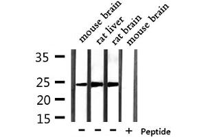 RAB15 Antikörper  (Internal Region)