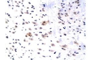 Formalin-fixed and paraffin embedded rat hippocampus labeled with Anti WIF1 Polyclonal Antibody, Unconjugated (ABIN751108) followed by conjugation to the secondary antibody and DAB staining (WIF1 Antikörper  (AA 51-150))