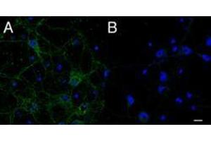 Immunofluorescence (IF) image for anti-Intraflagellar Transport Protein 74 Homolog (IFT74) (C-Term) antibody (ABIN185213)