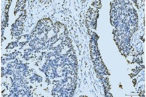 IHC analysis of MCM6 using anti-MCM6 antibody (ABIN7600037). (MCM6 Antikörper  (AA 14-821))