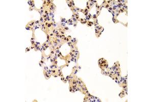 Immunohistochemistry of paraffin-embedded rat lung using ANP32A Antibody (ABIN5973390) at dilution of 1/100 (40x lens).