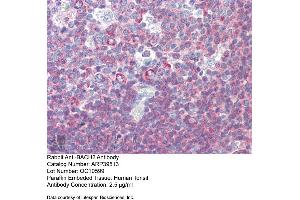 Immunohistochemistry (IHC) image for anti-BTB and CNC Homology 1, Basic Leucine Zipper Transcription Factor 2 (BACH2) (Middle Region) antibody (ABIN2781161)