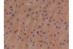 DAB staining on IHC-P; Samples: Human Liver Tissue (BMP1 Antikörper  (AA 610-843))