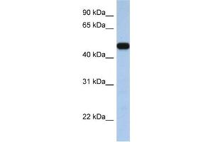 Western Blotting (WB) image for anti-Solute Carrier Family 25, Member 46 (SLC25A46) antibody (ABIN2458810)