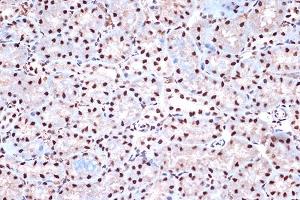 Immunohistochemistry of paraffin-embedded mouse kidney using KHSRP Rabbit mAb (ABIN7268110) at dilution of 1:100 (40x lens).