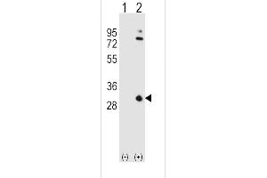 Western blot analysis of OA1 (arrow) using rabbit polyclonal OA1 Antibody (N-term) 7414a. (APOA1 Antikörper  (N-Term))