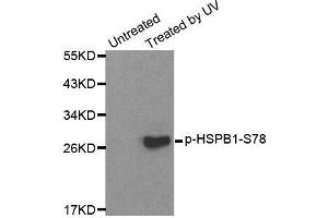 Western blot analysis of extracts from HL60 cells, using Phospho-HSPB1-S78 antibody (ABIN2987689). (HSP27 Antikörper  (pSer78))