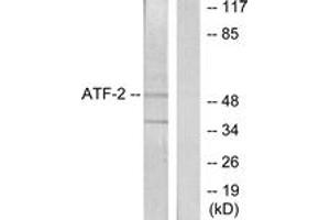 Western blot analysis of extracts from HeLa cells, using ATF2 (Ab-62 or 44) Antibody.