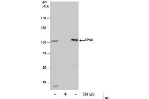 IP Image Immunoprecipitation of EPS8 protein from HepG2 whole cell extracts using 5 μg of EPS8 antibody [C3], C-term, Western blot analysis was performed using EPS8 antibody [C3], C-term, EasyBlot anti-Rabbit IgG  was used as a secondary reagent. (EPS8 Antikörper  (C-Term))