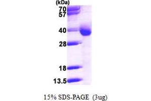 SDS-PAGE (SDS) image for Cytochrome B5 Reductase 3 (CYB5R3) (AA 27-301) protein (His tag) (ABIN667656)