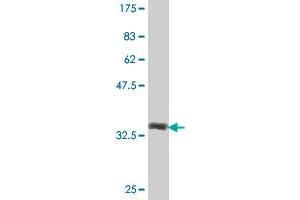 Western Blot detection against Immunogen (37 KDa) . (JAK1 Antikörper  (AA 221-320))