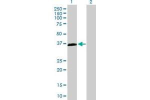 Western Blot analysis of OXER1 expression in transfected 293T cell line by OXER1 MaxPab polyclonal antibody. (OXER1 Antikörper  (AA 1-423))