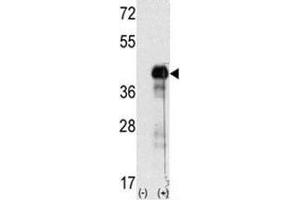 Western blot analysis of SOX-2 antibody and 293 cell lysate (2 ug/lane) either nontransfected (Lane 1) or transiently transfected with the SOX2 gene (2). (SOX2 Antikörper  (AA 89-119))