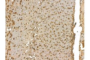 ABIN7094428 and ABIN7098476 at 1/100 staining Rat brain tissue by IHC-P.