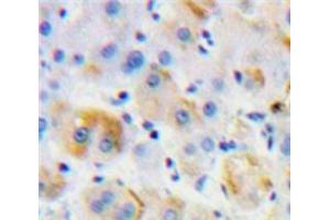 Used in DAB staining on fromalin fixed paraffin-embedded Liver tissue (MST1R Antikörper  (AA 1092-1316))