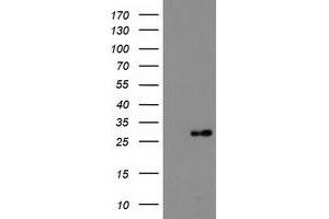 Western Blotting (WB) image for anti-Deoxythymidylate Kinase (Thymidylate Kinase) (DTYMK) antibody (ABIN1497925) (DTYMK Antikörper)