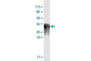 Western Blotting (WB) image for anti-HNF1 Homeobox A (HNF1A) (AA 532-631) antibody (ABIN2565605)
