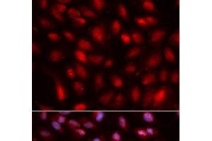 Immunofluorescence analysis of U2OS cells using SUMO2 Polyclonal Antibody (SUMO2 Antikörper)