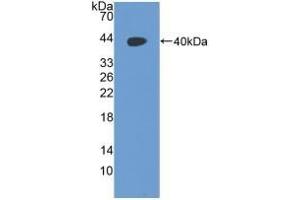 Detection of Recombinant RAD51, Human using Polyclonal Antibody to RAD51 Homolog (RAD51) (RAD51 Homolog Antikörper  (AA 2-339))