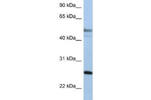 Western Blotting (WB) image for anti-Keratin 8 (KRT8) (Middle Region) antibody (ABIN2777113)