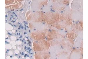IHC-P analysis of Mouse Skeletal muscle Tissue, with DAB staining. (IL12B Antikörper  (AA 35-302))