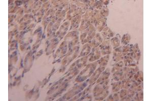 DAB staining on IHC-P; Samples: Mouse Adrenal gland Tissue (Hexokinase 1 Antikörper  (AA 530-675))