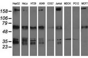 Western blot analysis of extracts (35 µg) from 9 different cell lines by using anti-IGF2BP2 monoclonal antibody.