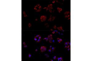 Immunofluorescence analysis of HeLa cells using CD40L antibody (ABIN6133614, ABIN6138190, ABIN6138191 and ABIN6216826) at dilution of 1:100.