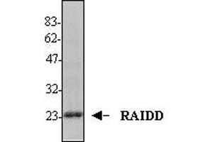 Image no. 1 for anti-CASP2 and RIPK1 Domain Containing Adaptor with Death Domain (CRADD) (AA 1-199) antibody (ABIN187937) (CRADD Antikörper  (AA 1-199))