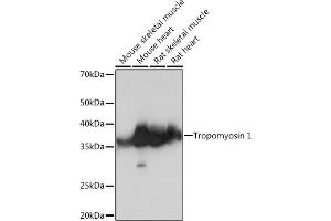 Western blot analysis of extracts of various cell lines, using Tropomyosin 1 Rabbit mAb (ABIN7271013) at 1:1000 dilution.