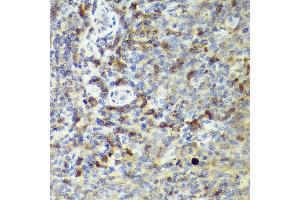 Immunohistochemistry of paraffin-embedded human tonsil using IL18 antibody (ABIN7267992) at dilution of 1:50 (40x lens). (IL-18 Antikörper)
