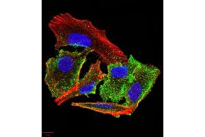 Immunocytochemistry (ICC) image for anti-Transthyretin (TTR) (AA 1-147) antibody (ABIN5875576) (TTR Antikörper  (AA 1-147))