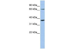 WB Suggested Anti-ZNF274  Antibody Titration: 0. (ZNF274 Antikörper  (Middle Region))