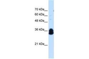 Image no. 2 for anti-Family with Sequence Similarity 134, Member B (FAM134B) (AA 160-209) antibody (ABIN205065) (FAM134B Antikörper  (AA 160-209))