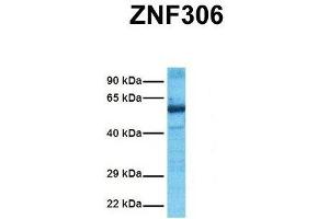 Host:  Rabbit  Target Name:  ZNF306  Sample Tissue:  Human Ovary Tumor  Antibody Dilution:  1. (ZKSCAN3 Antikörper  (N-Term))