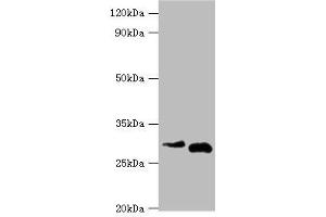 Western blot All lanes: Cerberus antibody at 2 μg/mL Lane 1: Hela whole cell lysate Lane 2: Rat kidney tissue Secondary Goat polyclonal to rabbit IgG at 1/10000 dilution Predicted band size: 30 kDa Observed band size: 30 kDa (CER1 Antikörper  (AA 18-267))